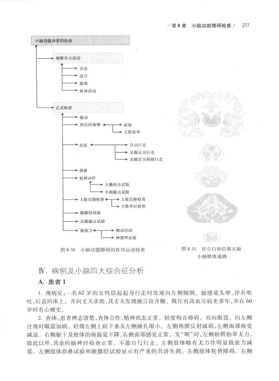 DEMYER+神经系统检查++原书第6版_13200349_301-320.pdf_第1页