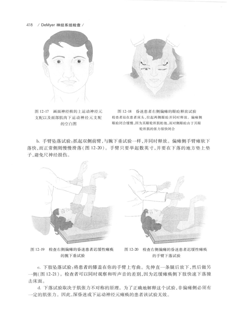 DEMYER+神经系统检查++原书第6版_13200349_441-460.pdf_第2页