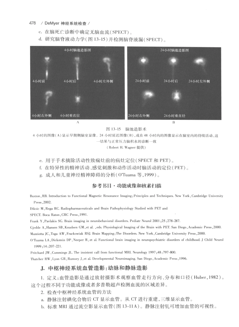 DEMYER+神经系统检查++原书第6版_13200349_501-520.pdf_第2页
