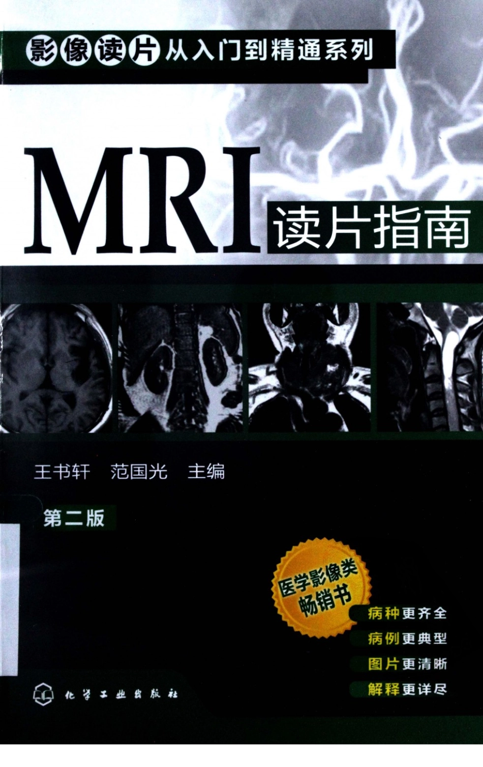 MRI读片指南_13265768_1-15.pdf_第1页