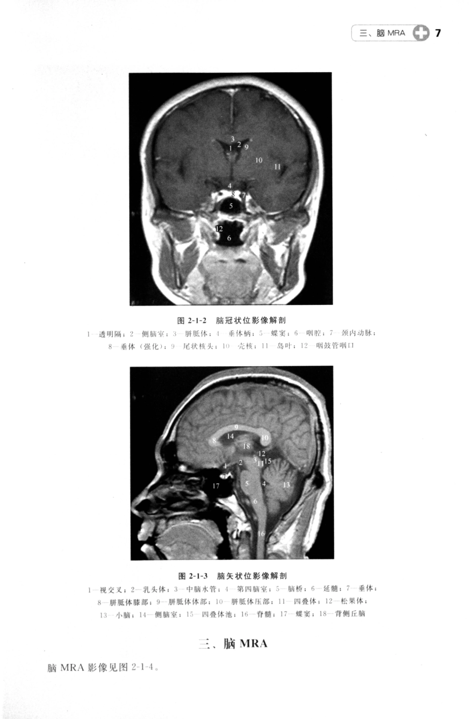 MRI读片指南_13265768_16-30.pdf_第3页