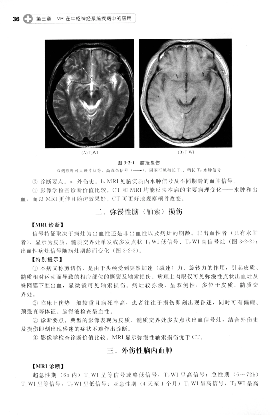 MRI读片指南_13265768_46-60.pdf_第2页