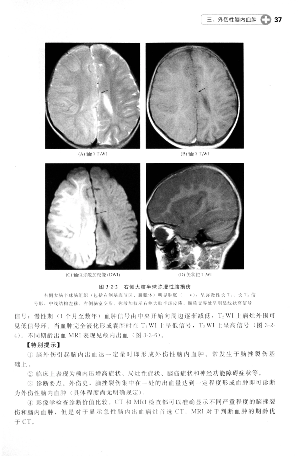 MRI读片指南_13265768_46-60.pdf_第3页