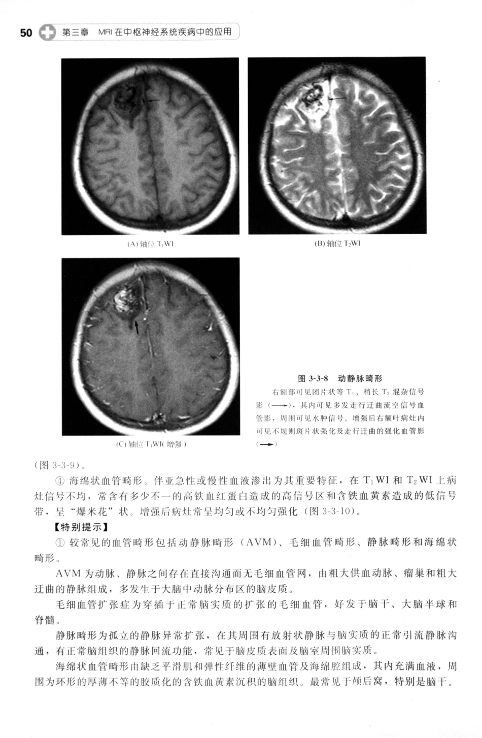 MRI读片指南_13265768_61-75.pdf_第1页