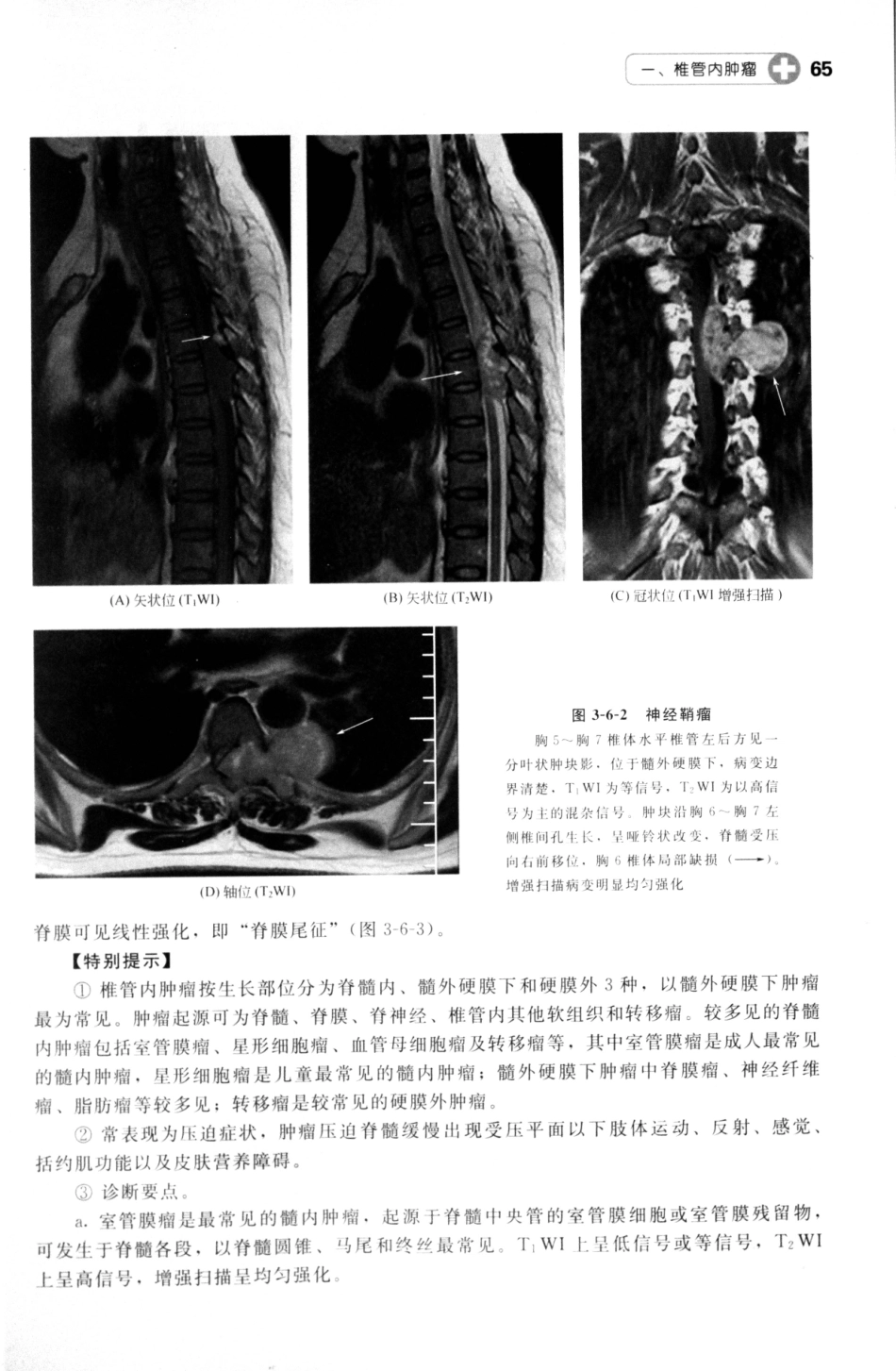 MRI读片指南_13265768_76-90.pdf_第1页