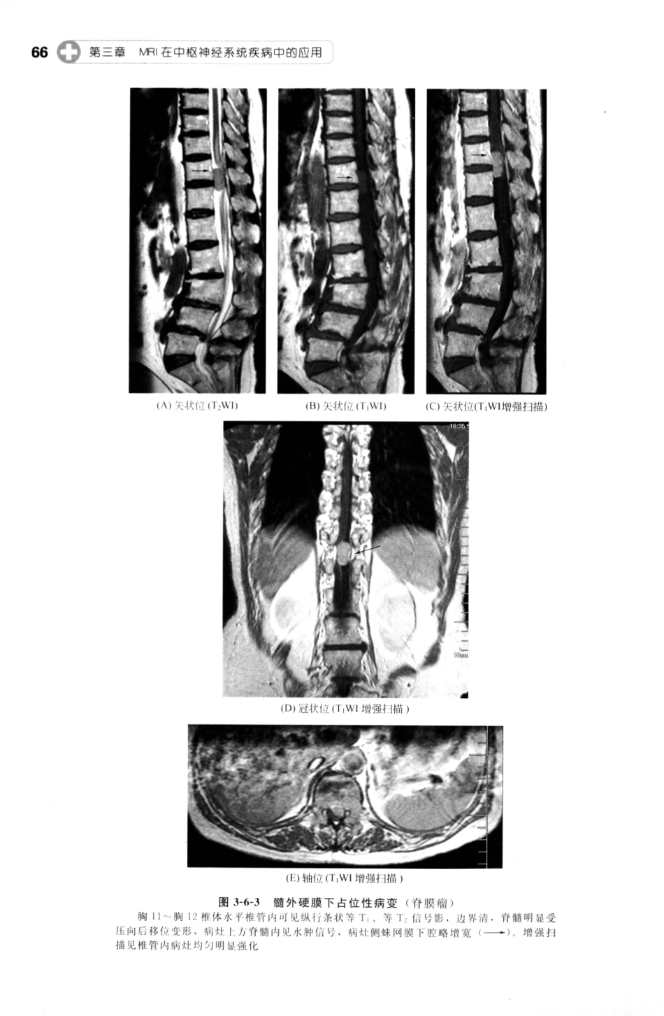 MRI读片指南_13265768_76-90.pdf_第2页