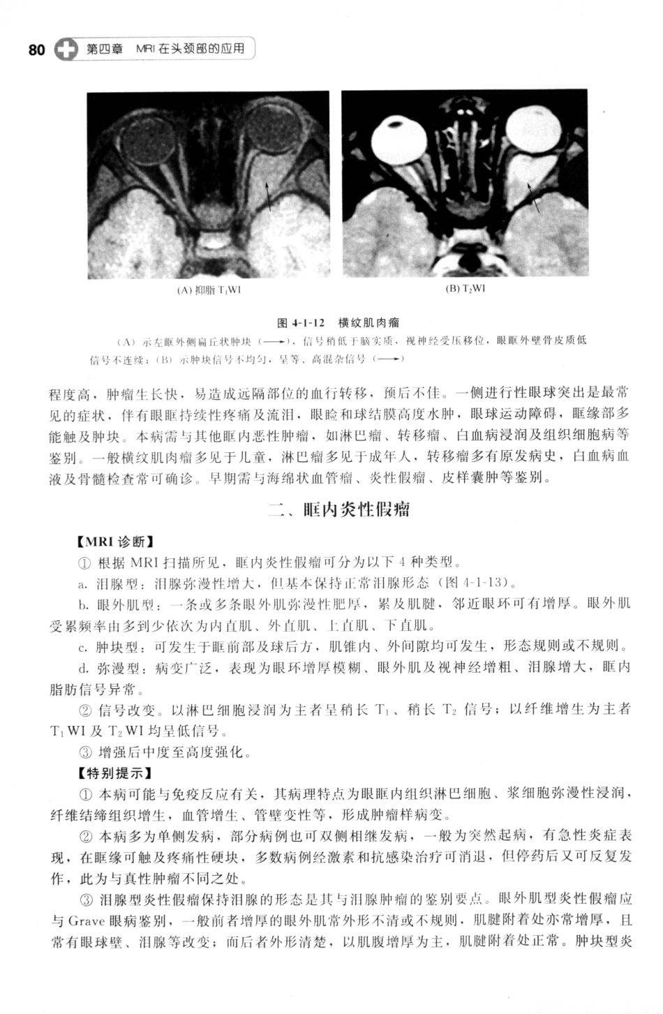 MRI读片指南_13265768_91-105.pdf_第1页