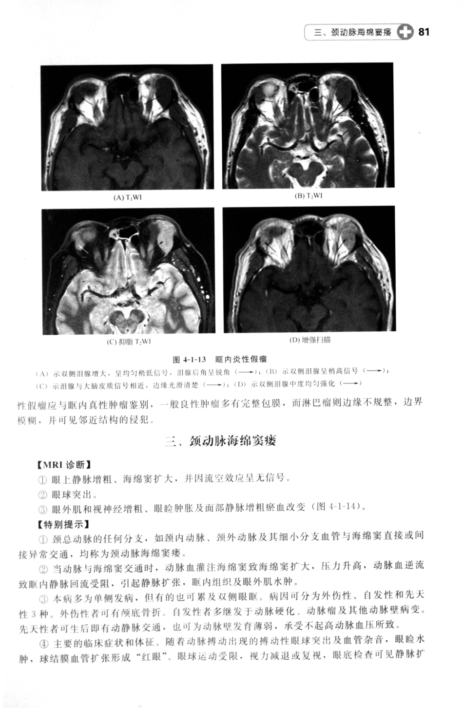 MRI读片指南_13265768_91-105.pdf_第2页
