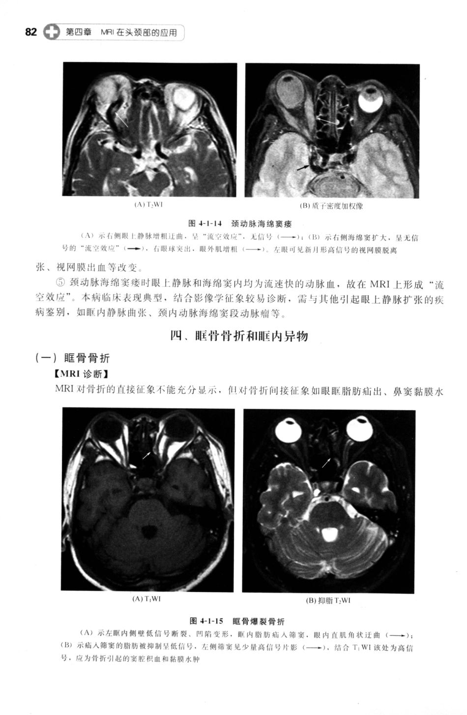 MRI读片指南_13265768_91-105.pdf_第3页
