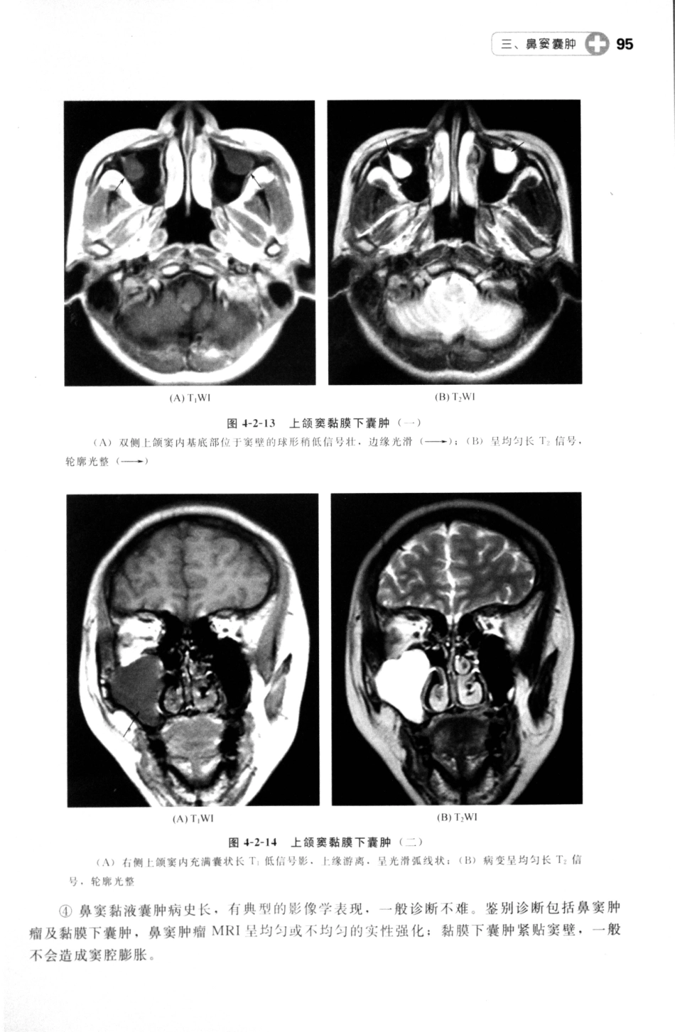 MRI读片指南_13265768_106-120.pdf_第1页