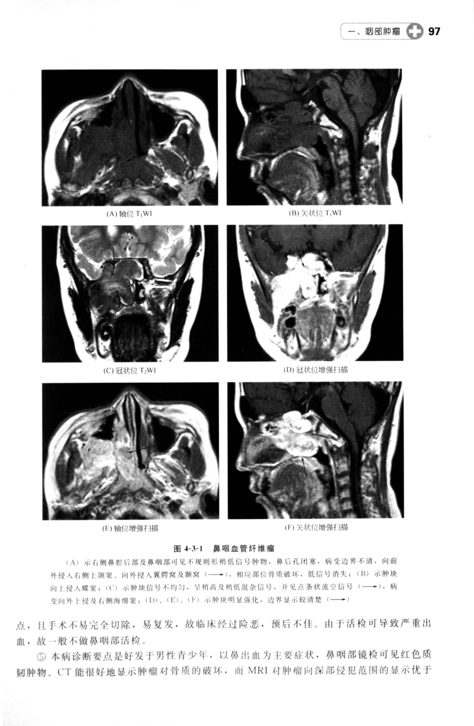 MRI读片指南_13265768_106-120.pdf_第3页