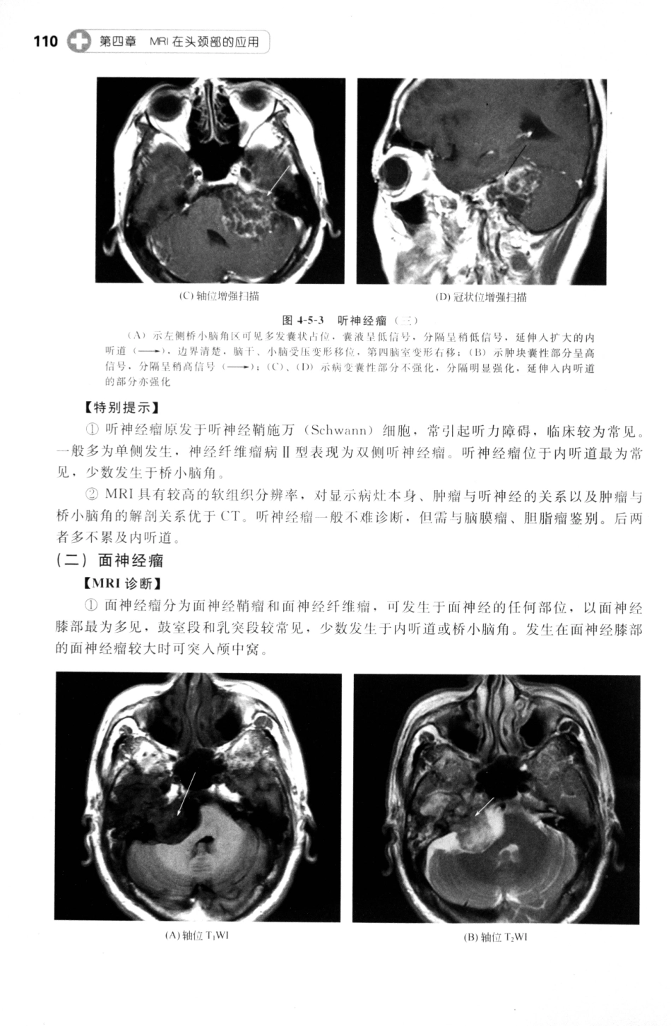 MRI读片指南_13265768_121-135.pdf_第1页