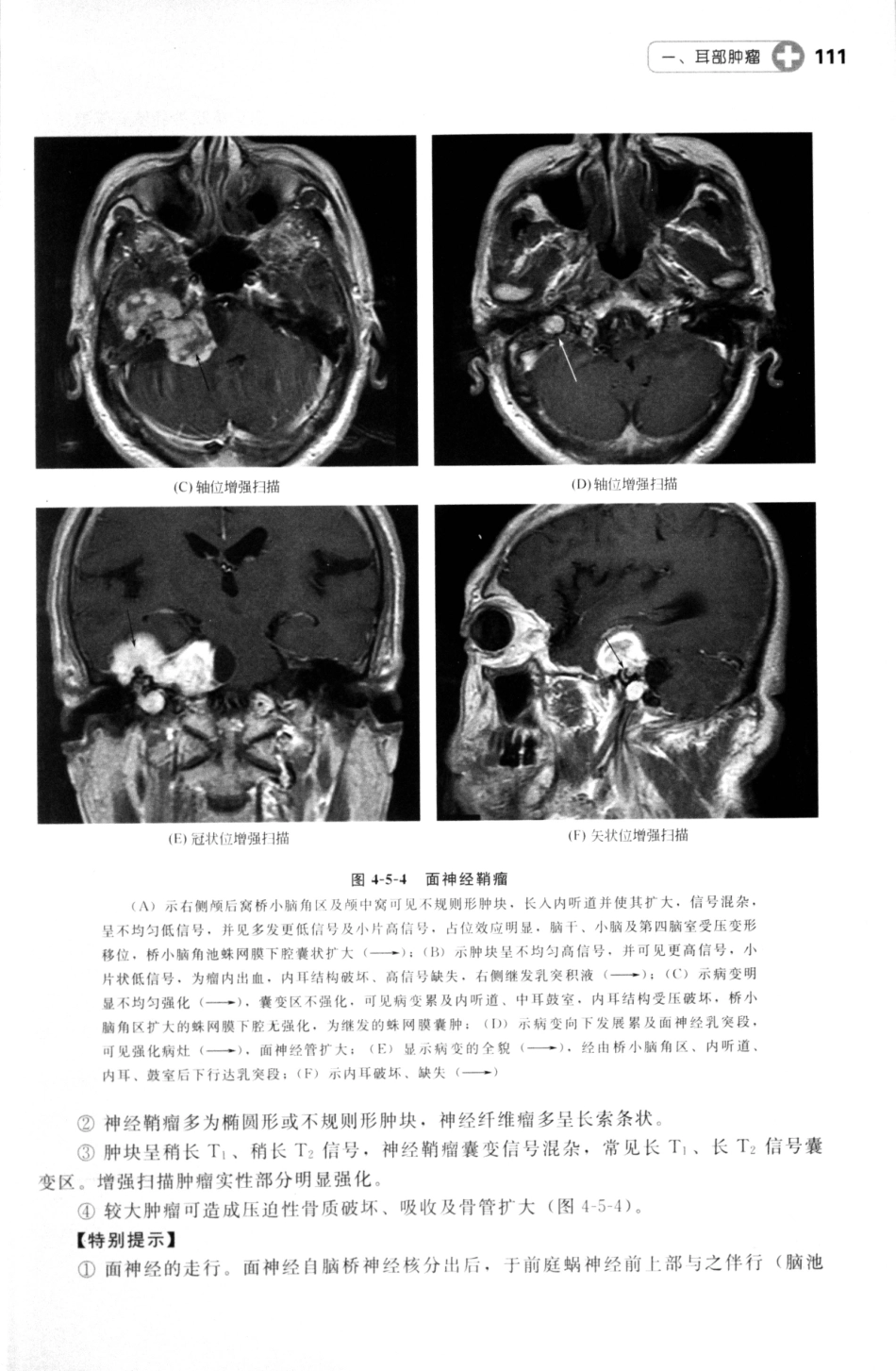 MRI读片指南_13265768_121-135.pdf_第2页