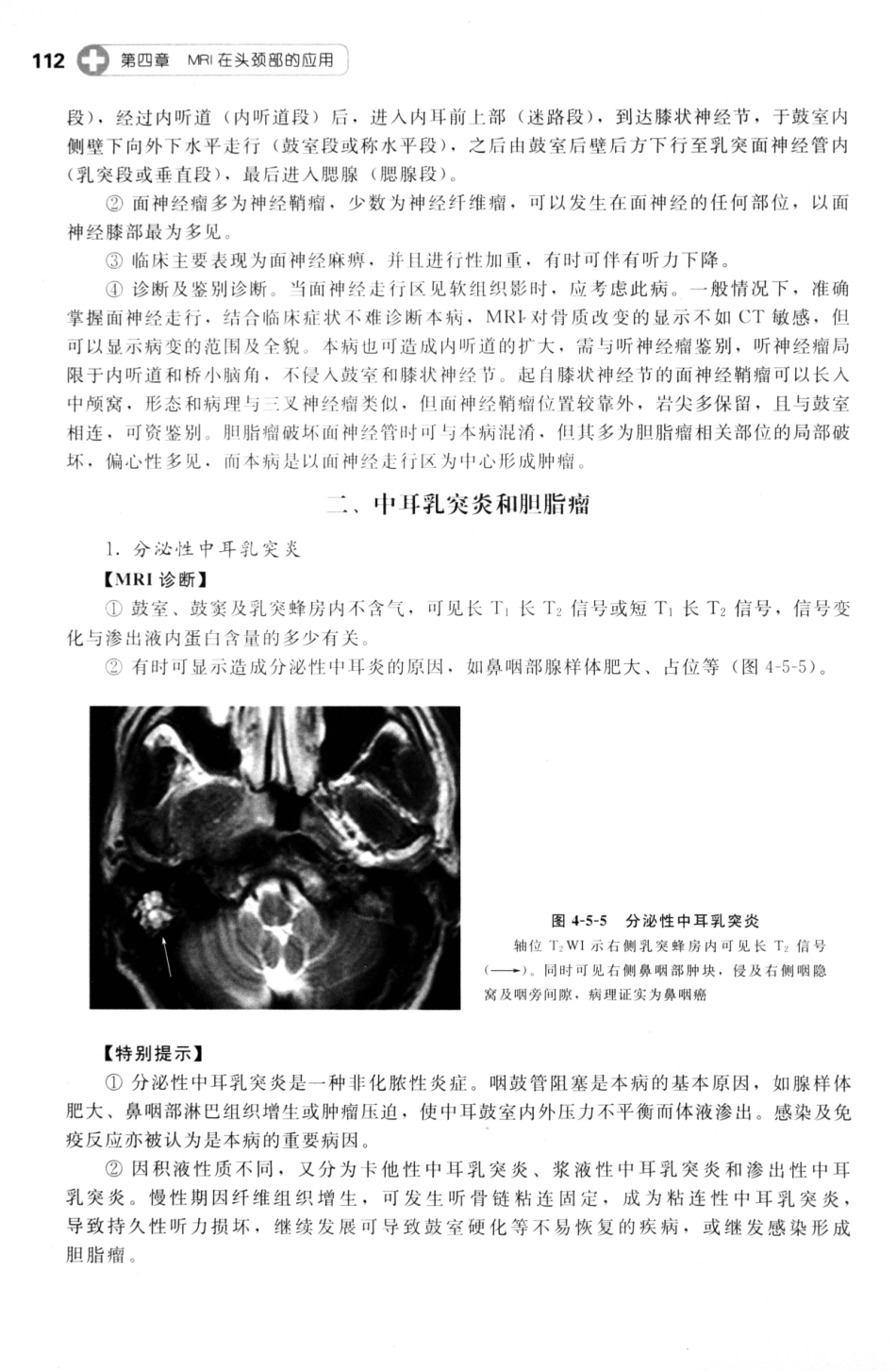 MRI读片指南_13265768_121-135.pdf_第3页