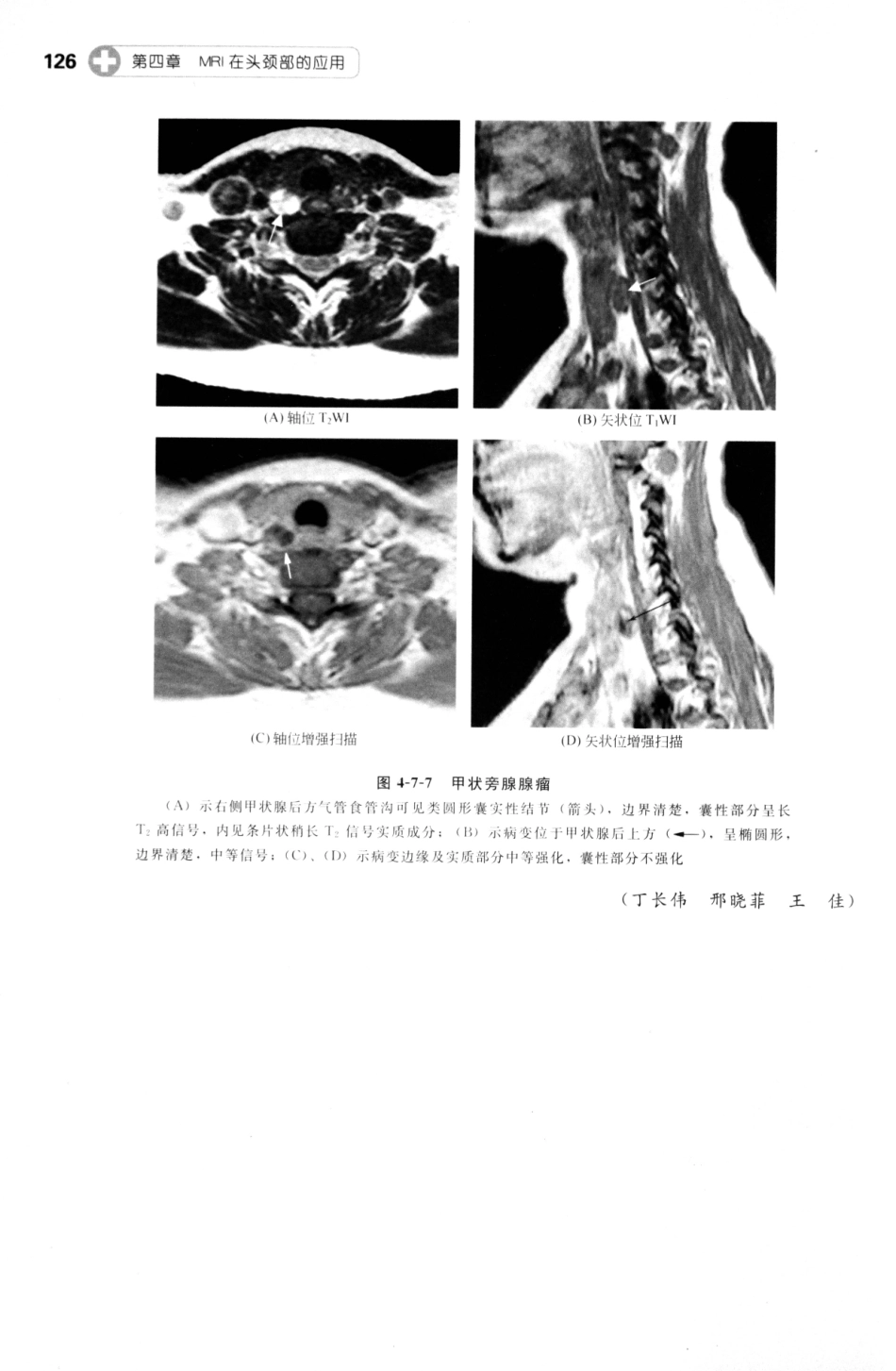 MRI读片指南_13265768_136-150.pdf_第2页