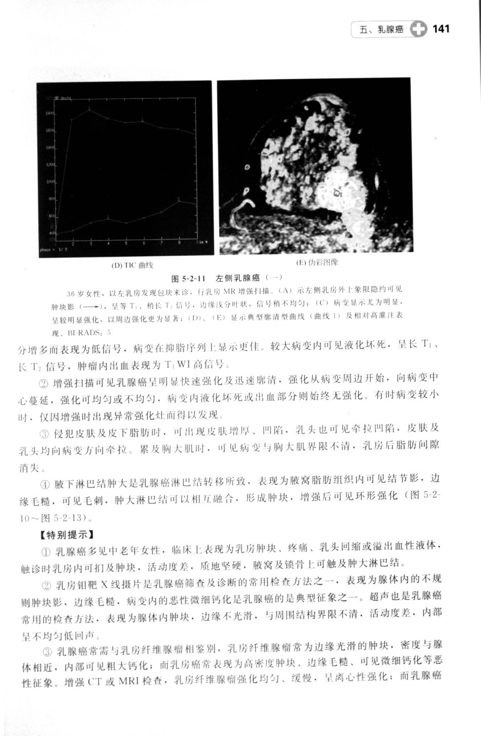 MRI读片指南_13265768_151-165.pdf_第2页