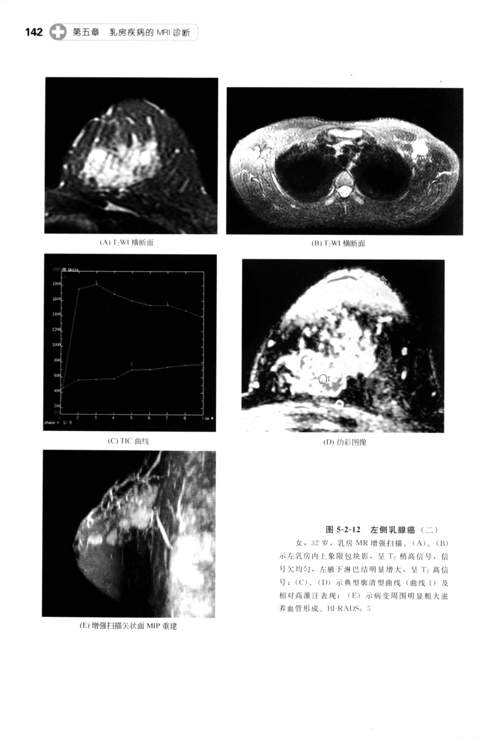 MRI读片指南_13265768_151-165.pdf_第3页