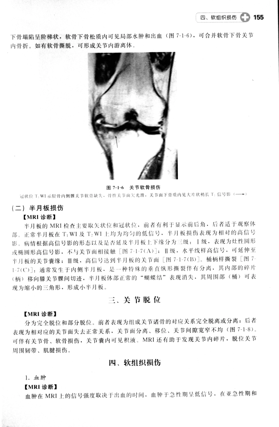 MRI读片指南_13265768_166-180.pdf_第1页