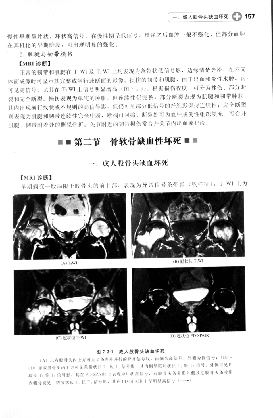MRI读片指南_13265768_166-180.pdf_第3页