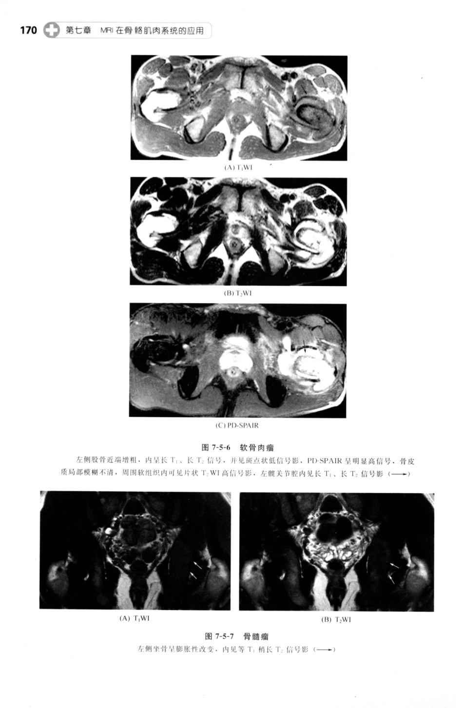 MRI读片指南_13265768_181-195.pdf_第1页