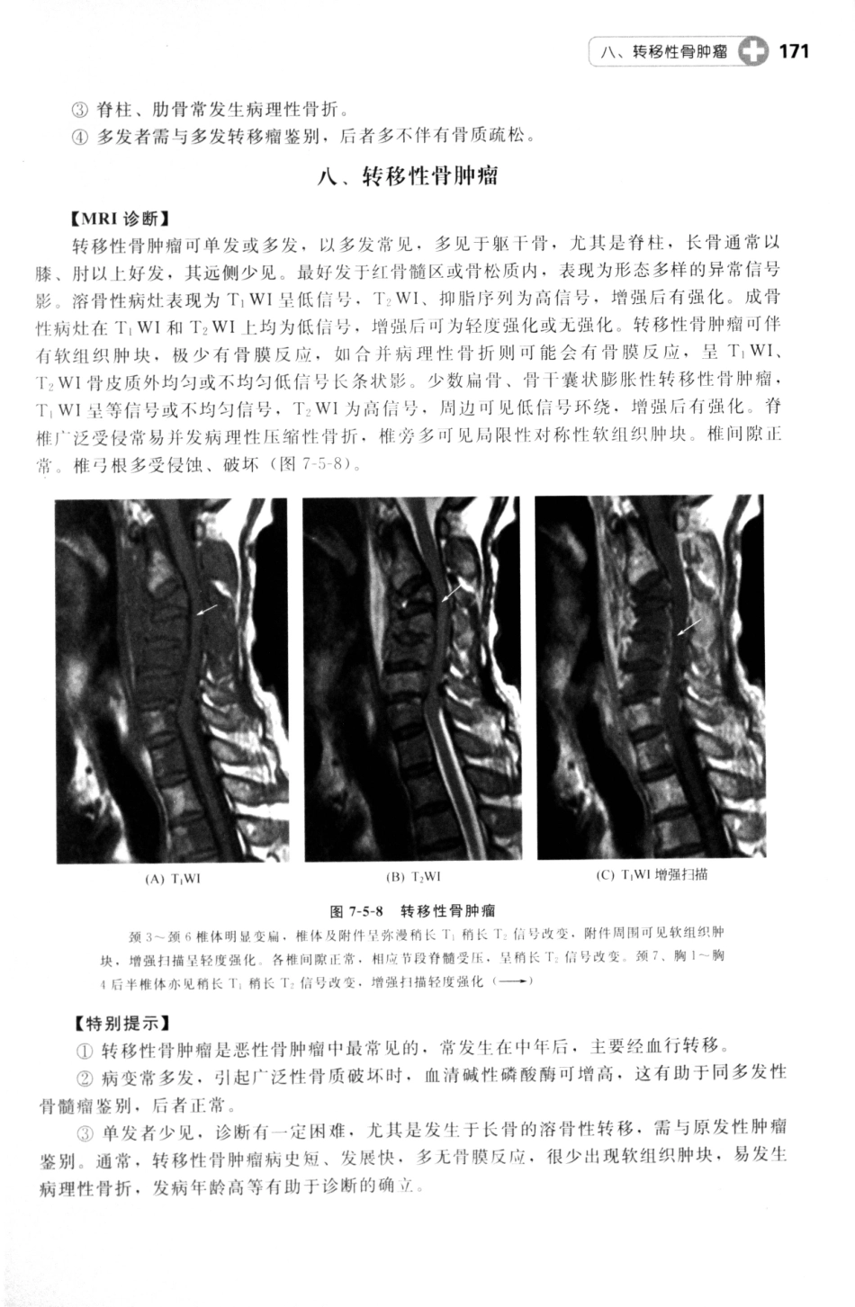 MRI读片指南_13265768_181-195.pdf_第2页
