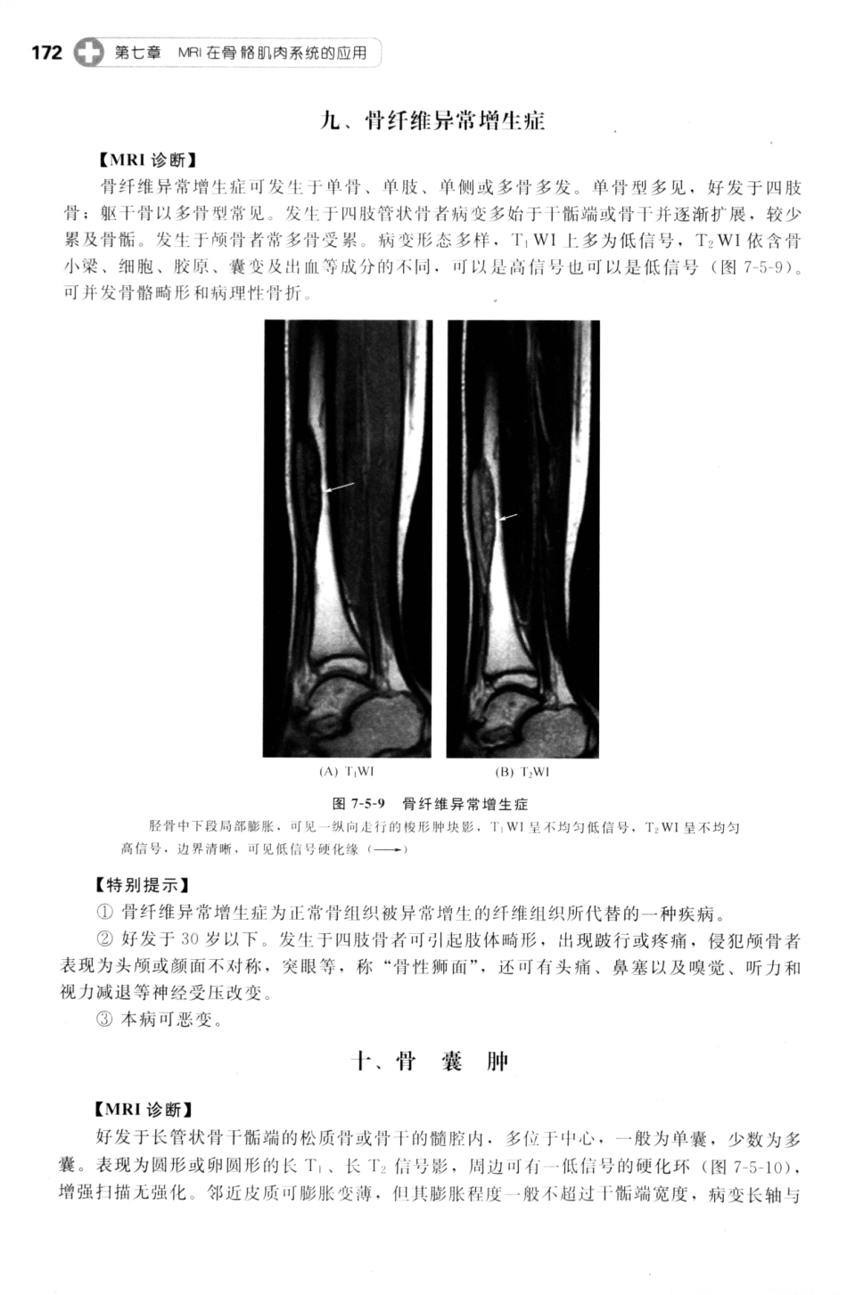 MRI读片指南_13265768_181-195.pdf_第3页