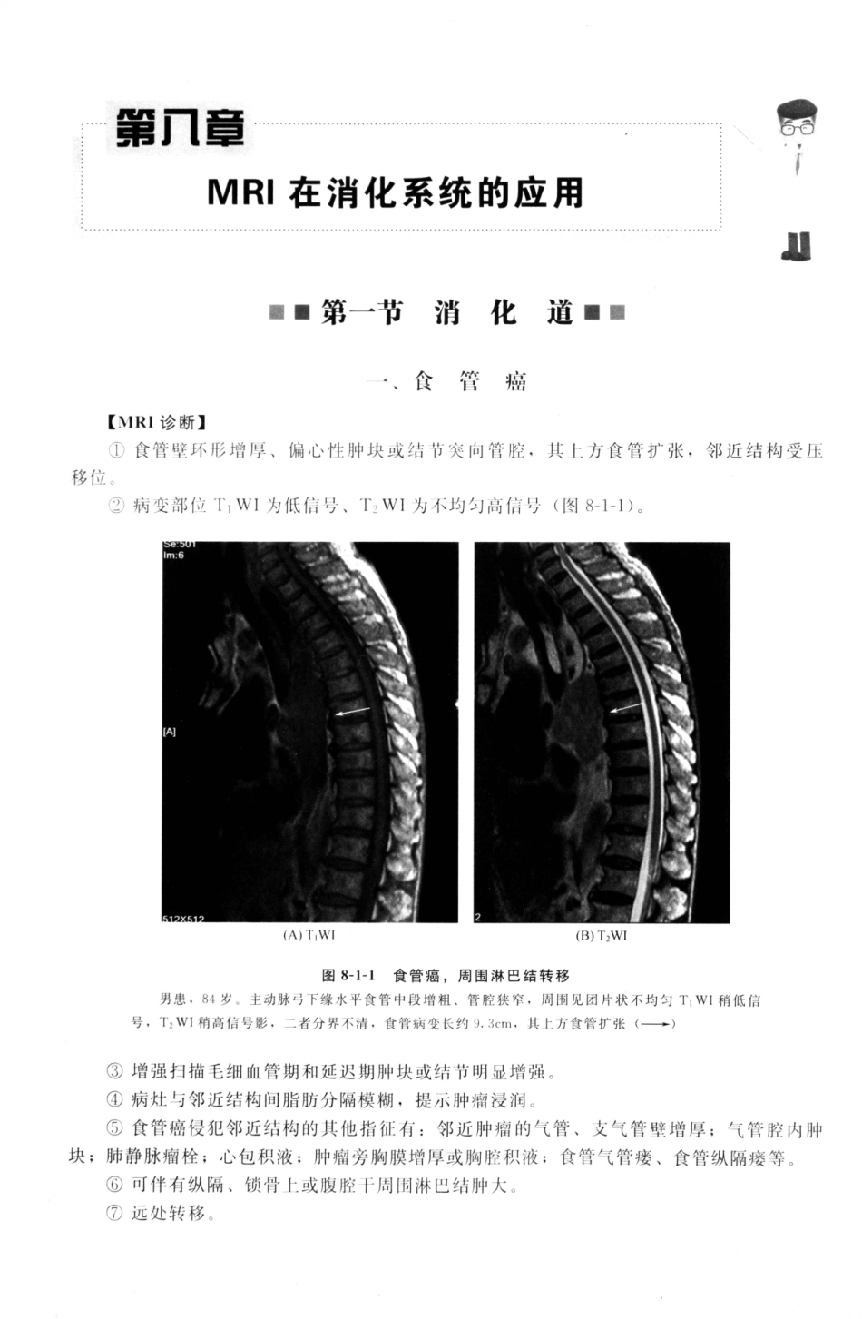 MRI读片指南_13265768_196-210.pdf_第2页