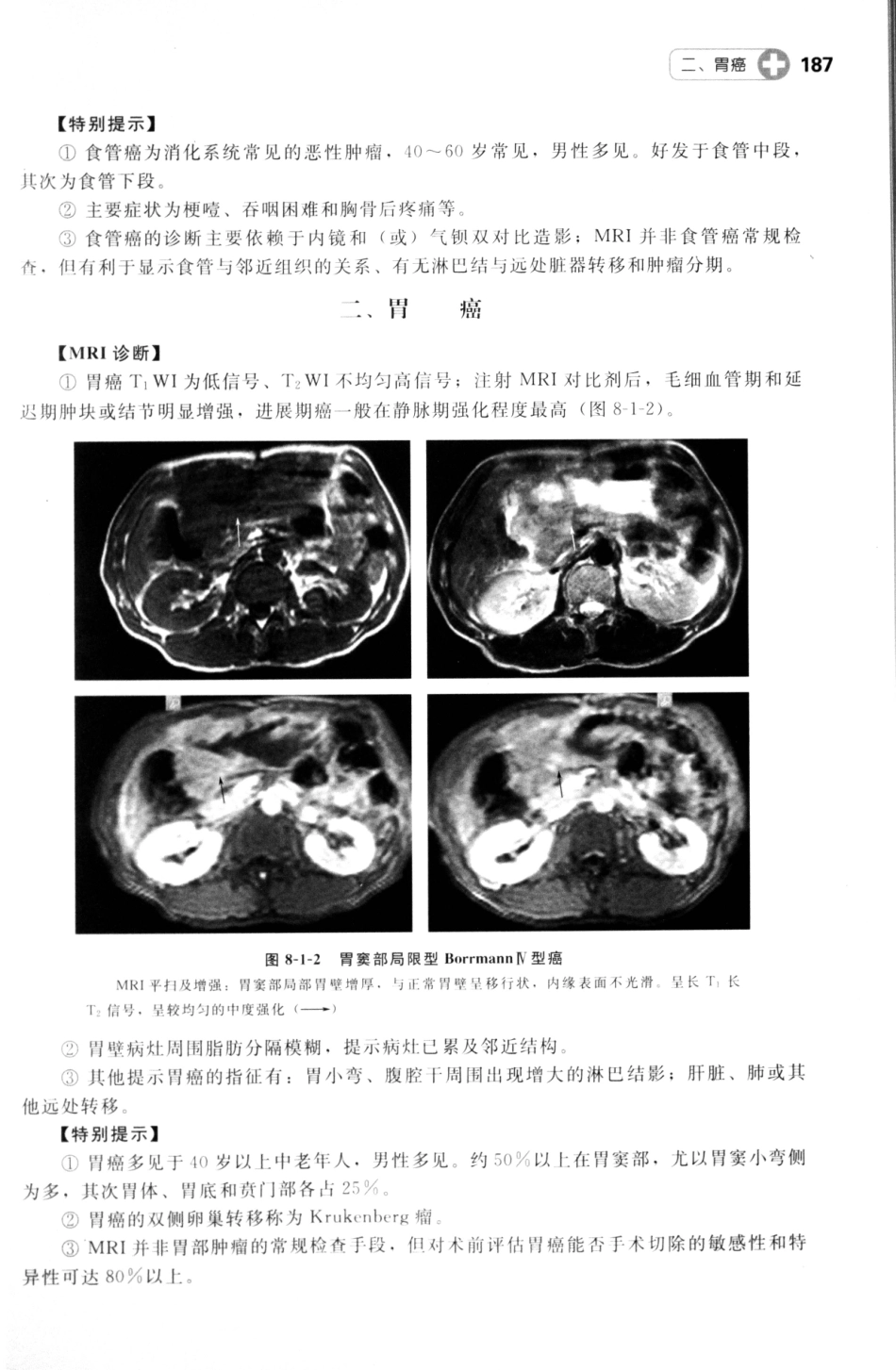 MRI读片指南_13265768_196-210.pdf_第3页