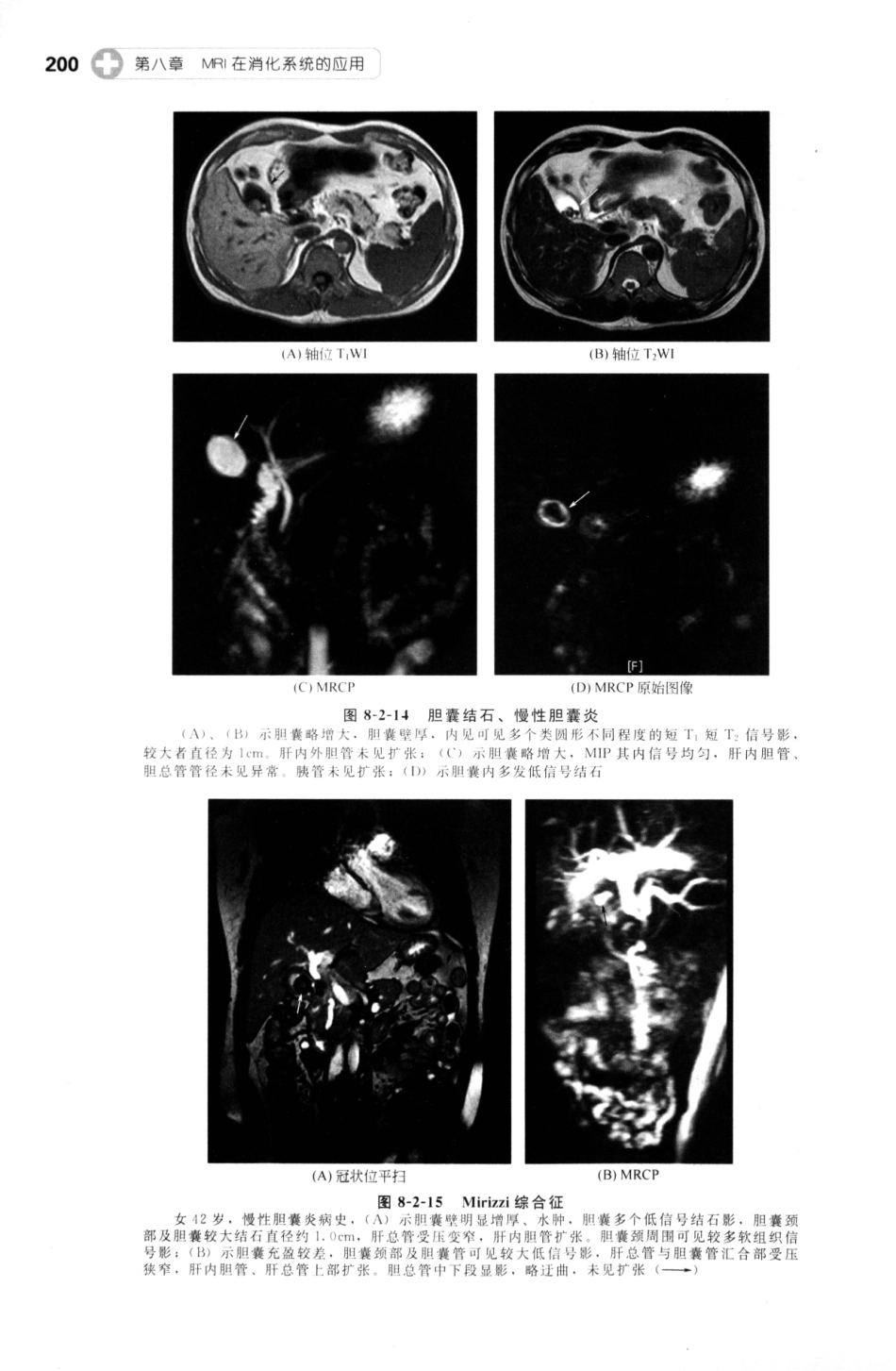 MRI读片指南_13265768_211-225.pdf_第1页