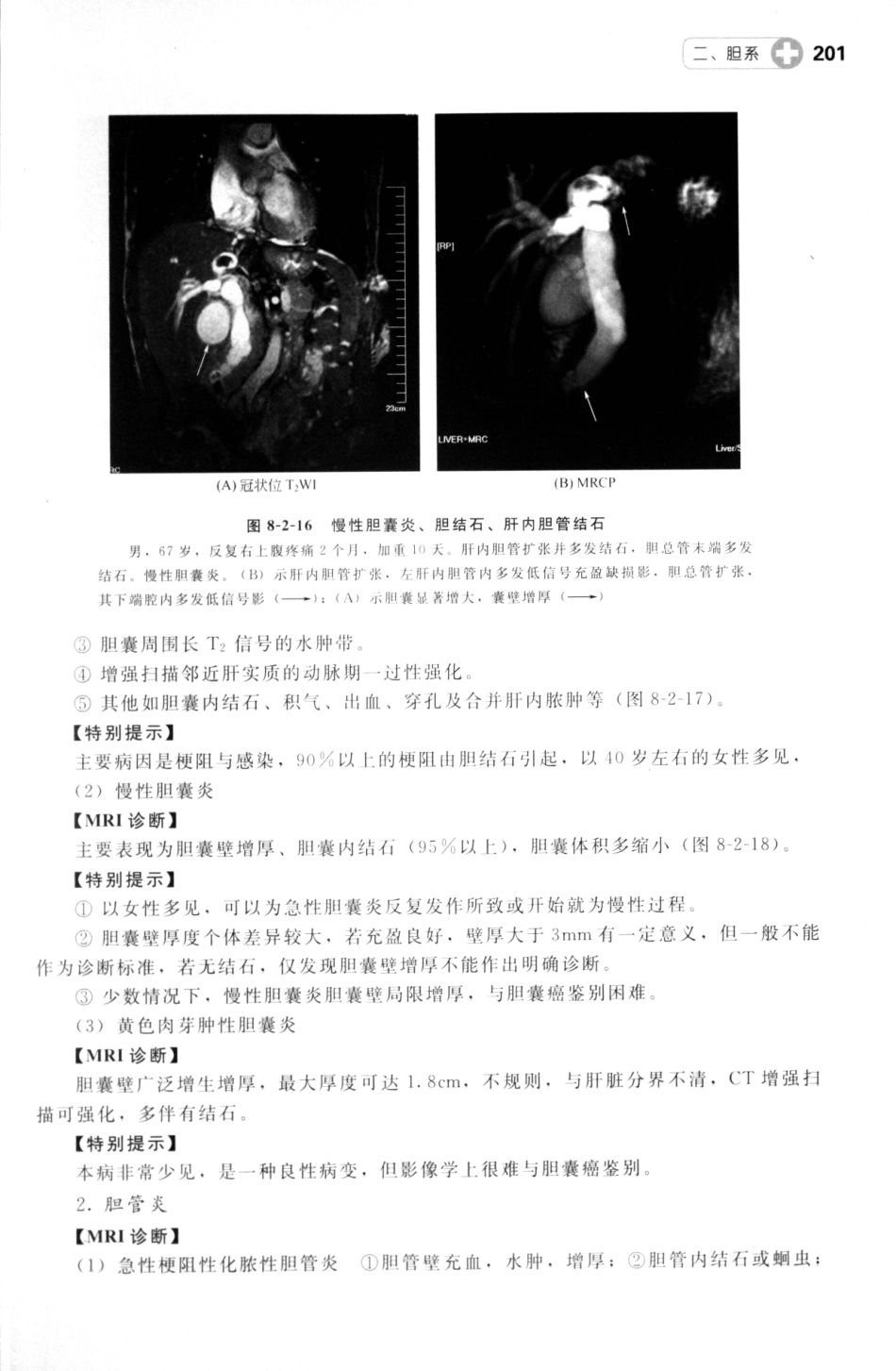 MRI读片指南_13265768_211-225.pdf_第2页