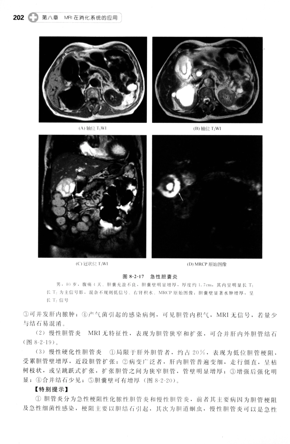 MRI读片指南_13265768_211-225.pdf_第3页