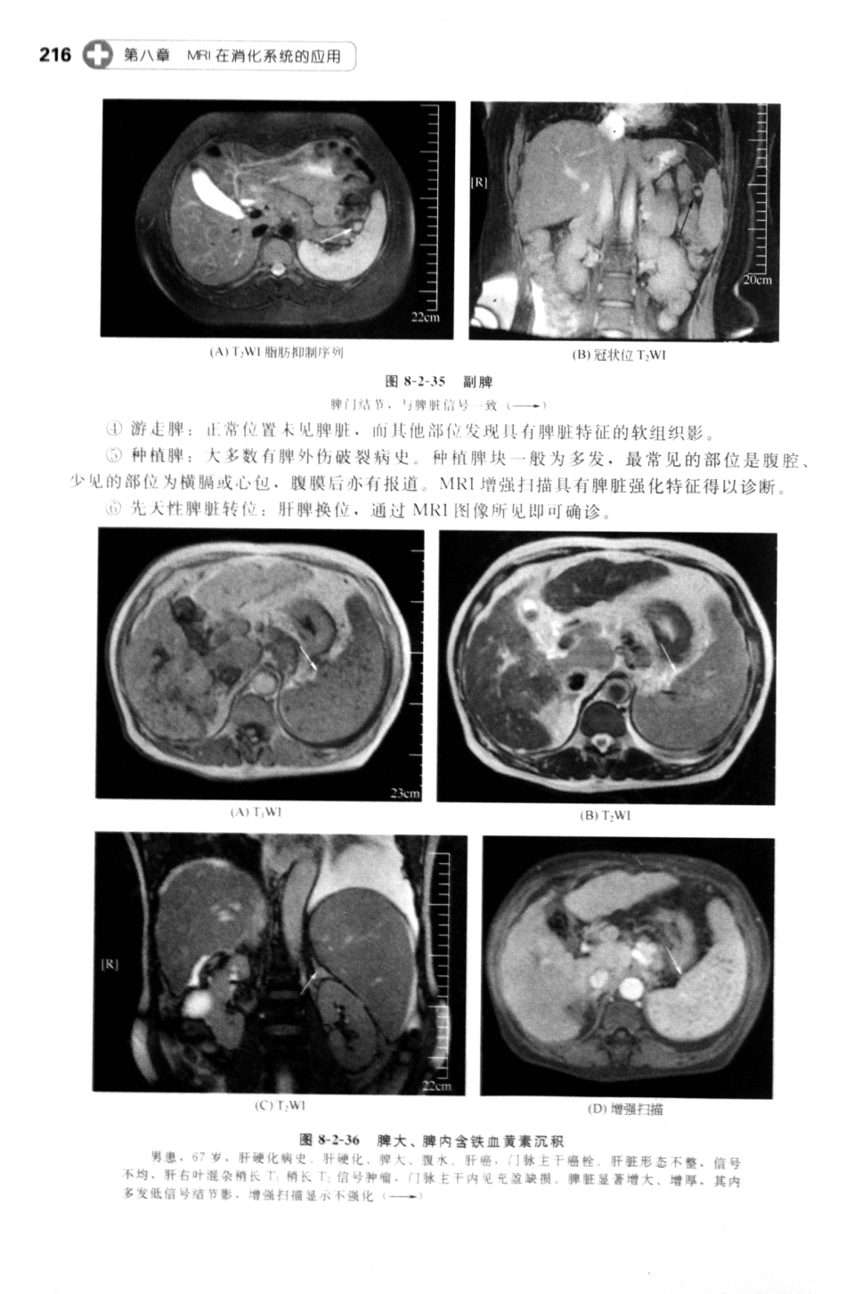 MRI读片指南_13265768_226-240.pdf_第2页