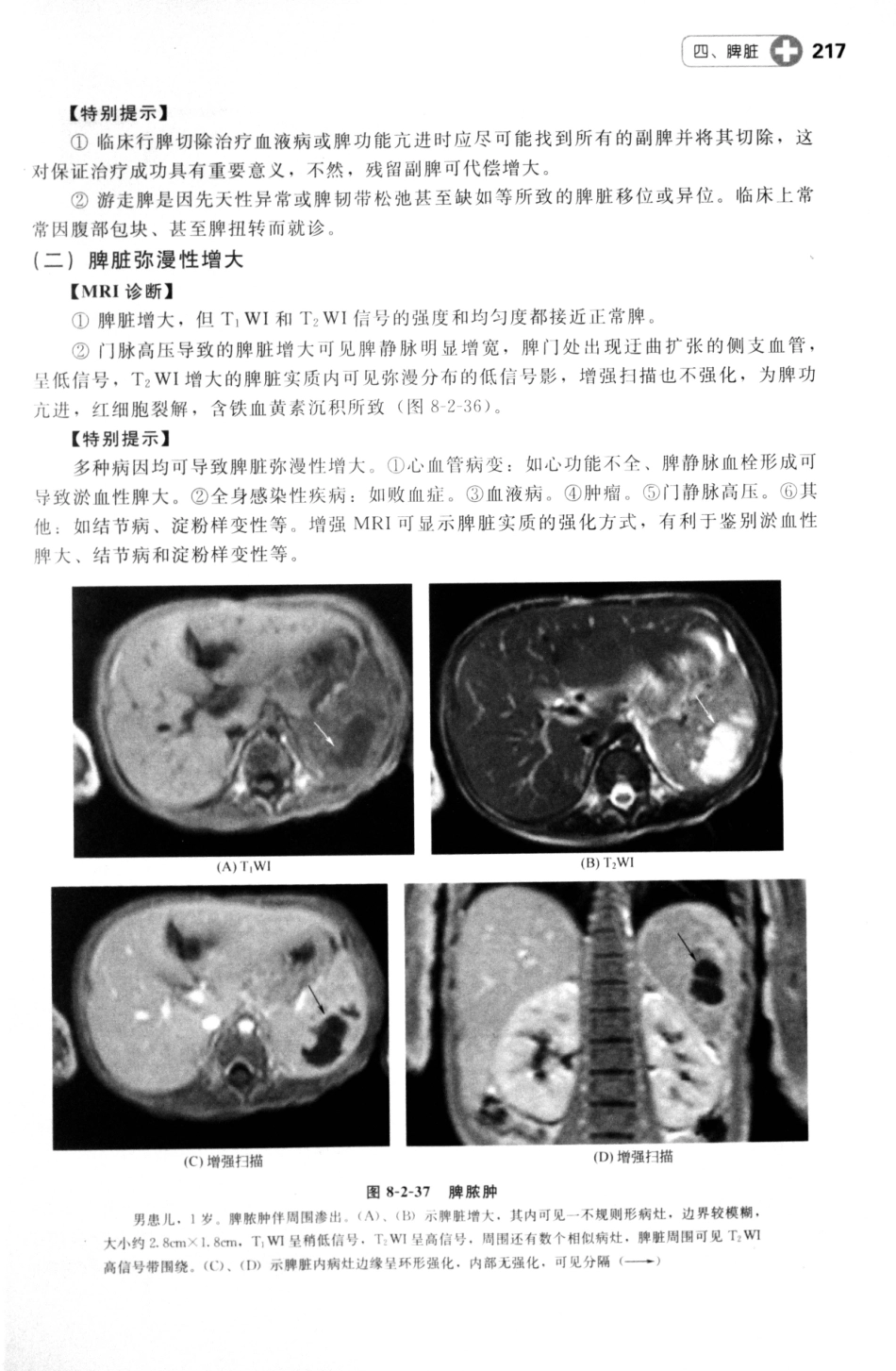 MRI读片指南_13265768_226-240.pdf_第3页