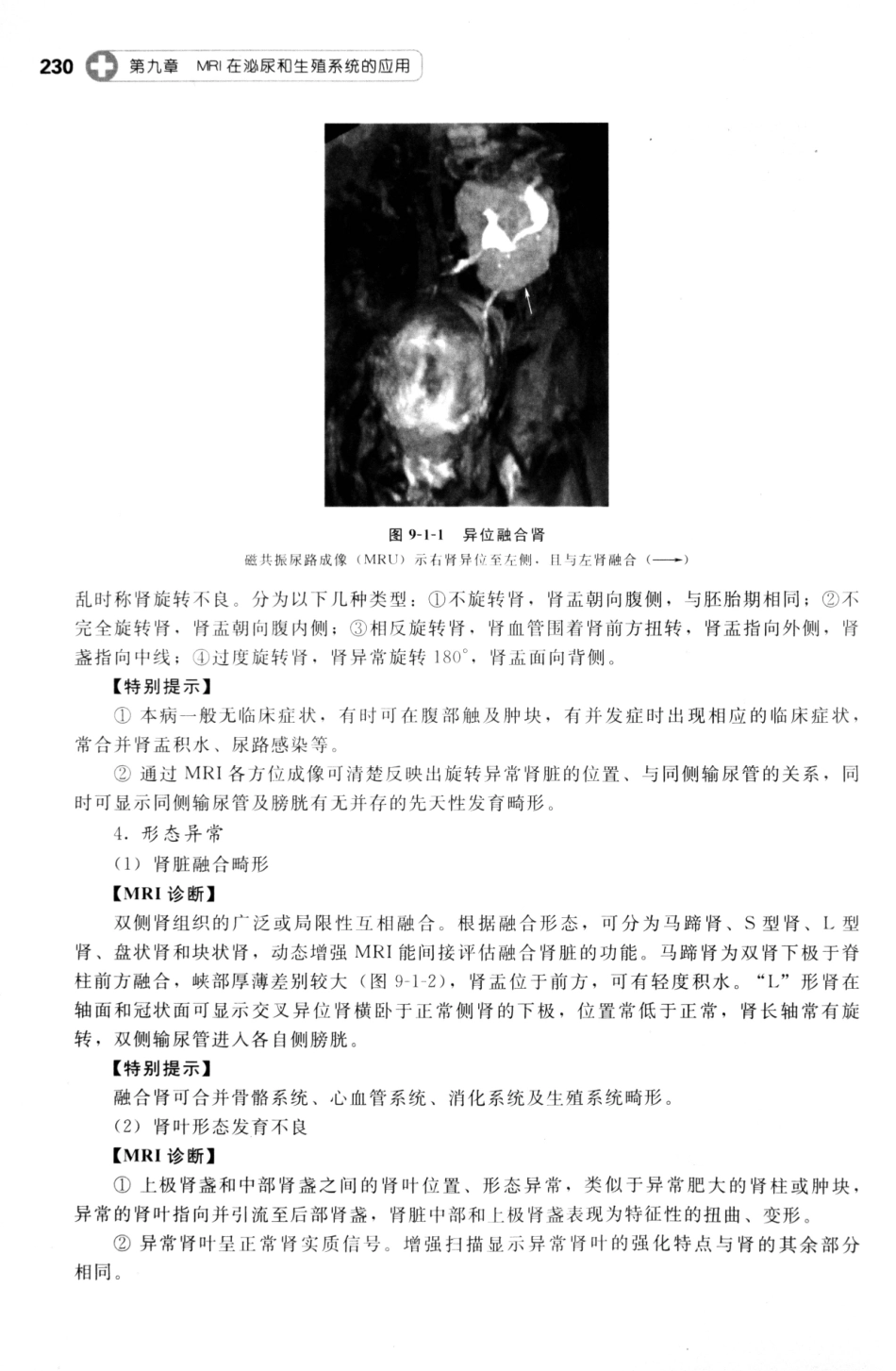 MRI读片指南_13265768_241-255.pdf_第1页