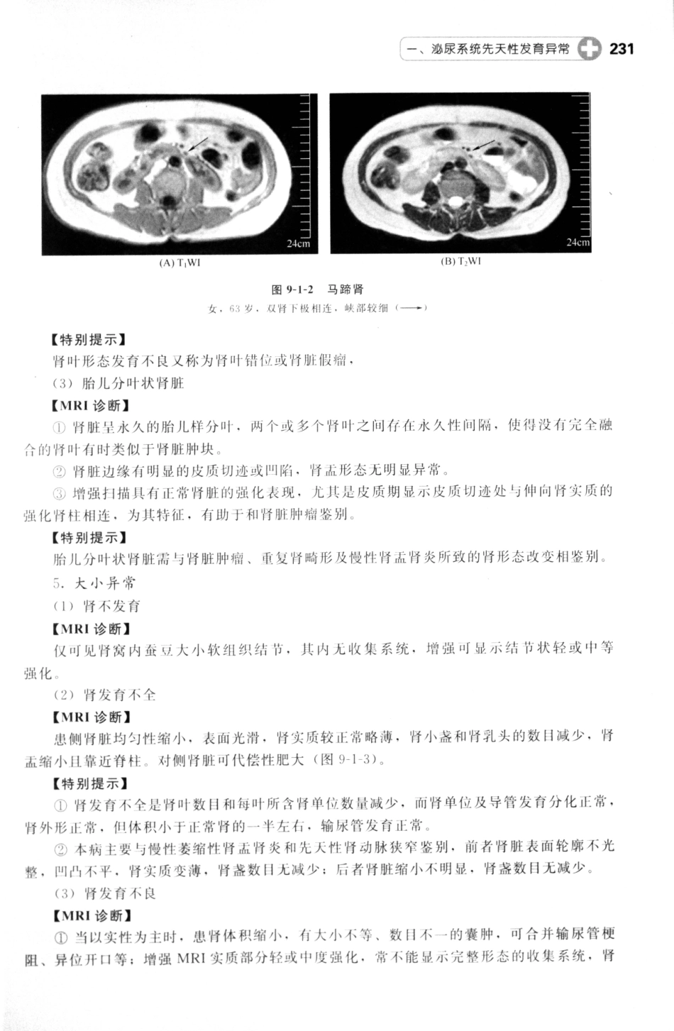 MRI读片指南_13265768_241-255.pdf_第2页