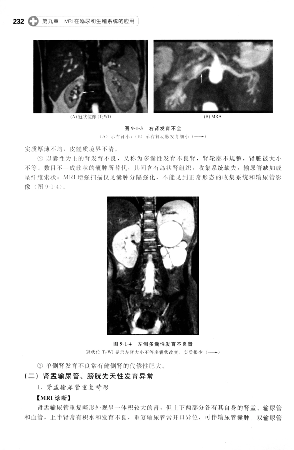 MRI读片指南_13265768_241-255.pdf_第3页