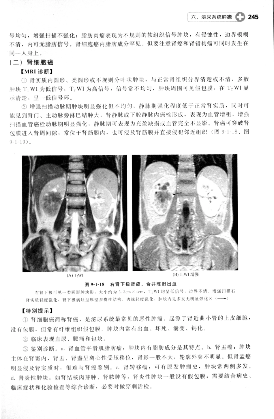 MRI读片指南_13265768_256-270.pdf_第1页