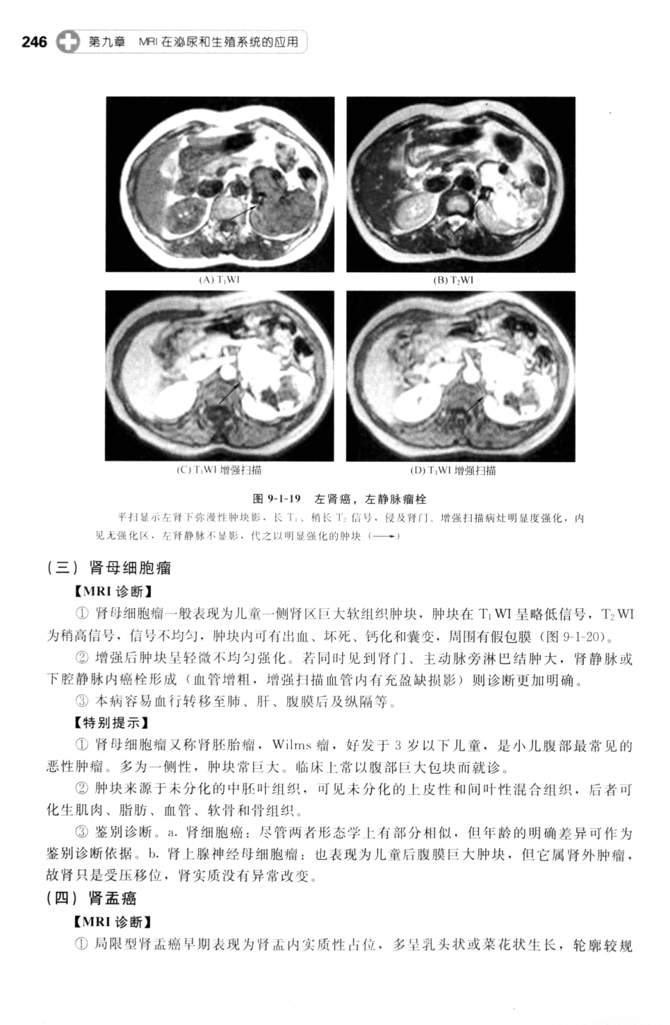 MRI读片指南_13265768_256-270.pdf_第2页