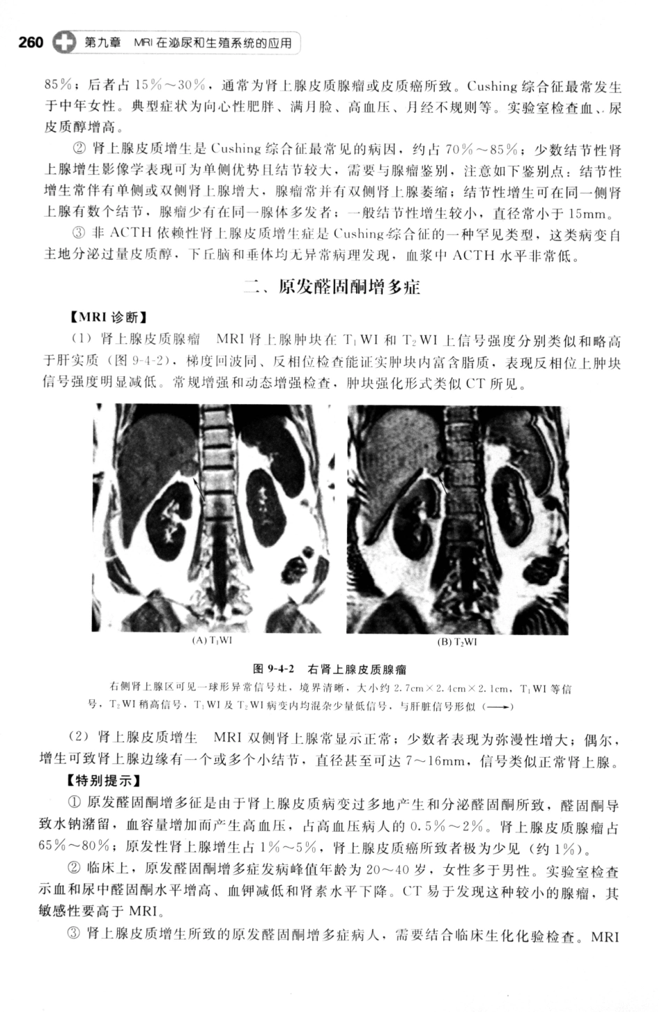 MRI读片指南_13265768_271-277.pdf_第1页