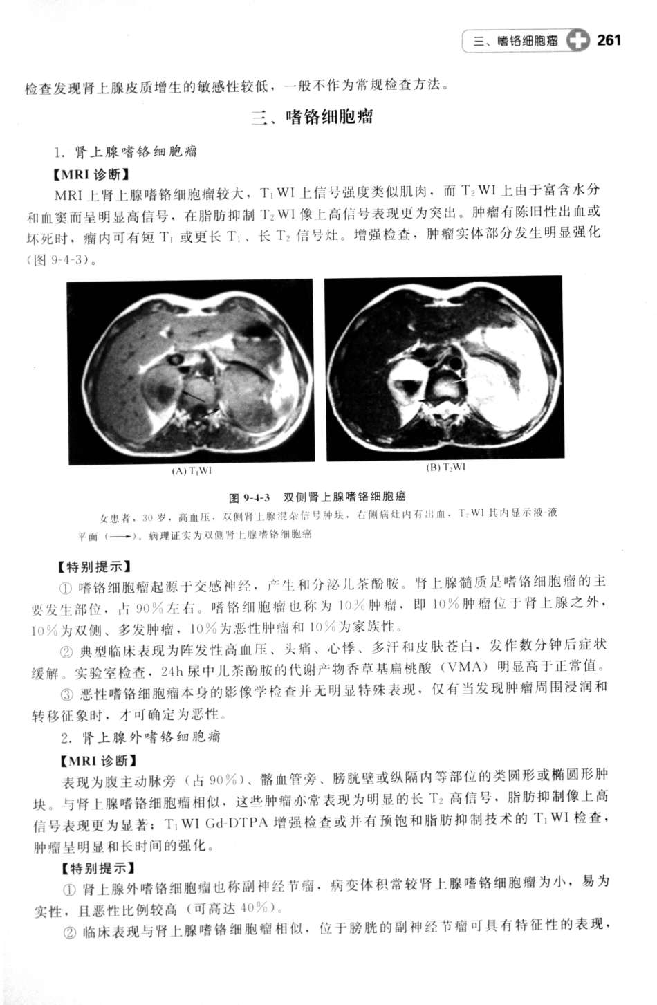 MRI读片指南_13265768_271-277.pdf_第2页