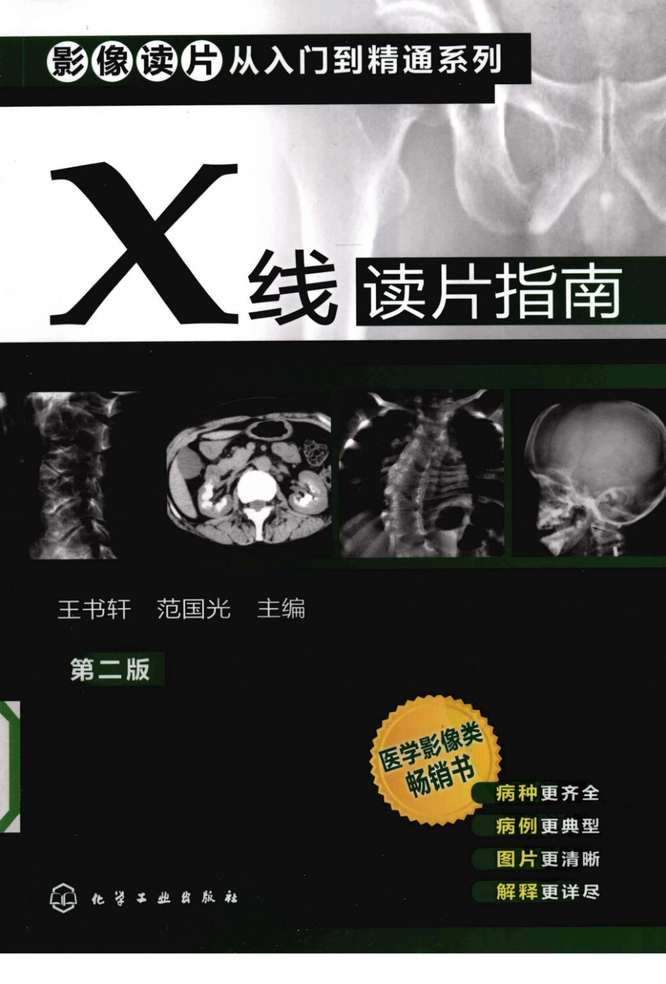 X线读片指南_13282062_1-15.pdf_第1页