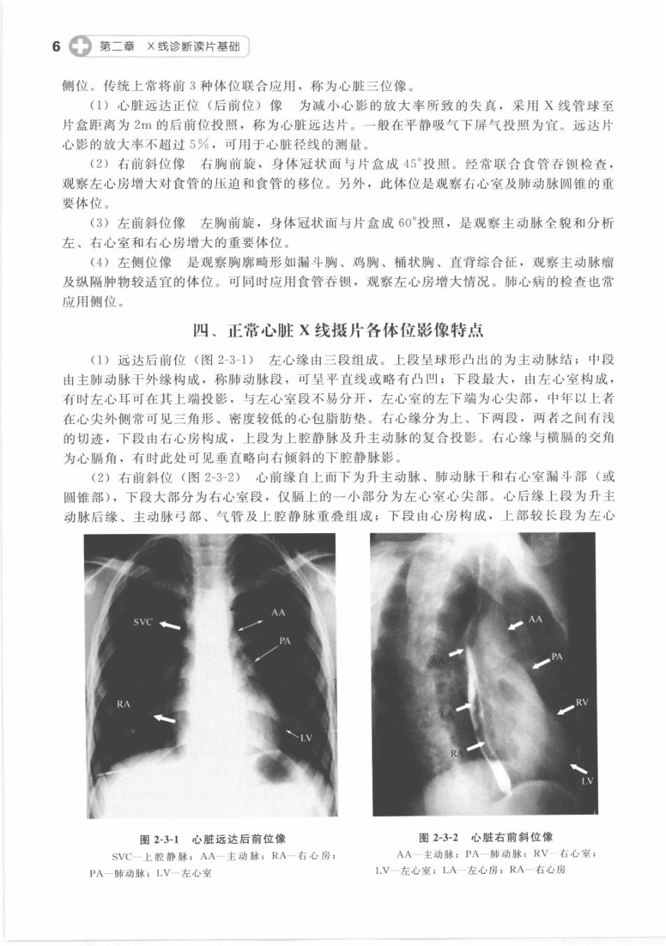 X线读片指南_13282062_16-30.pdf_第2页