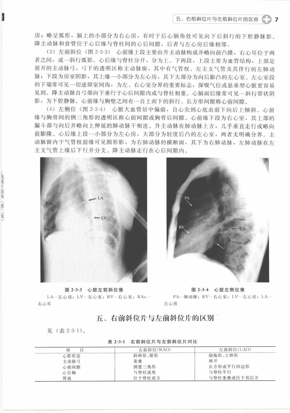 X线读片指南_13282062_16-30.pdf_第3页