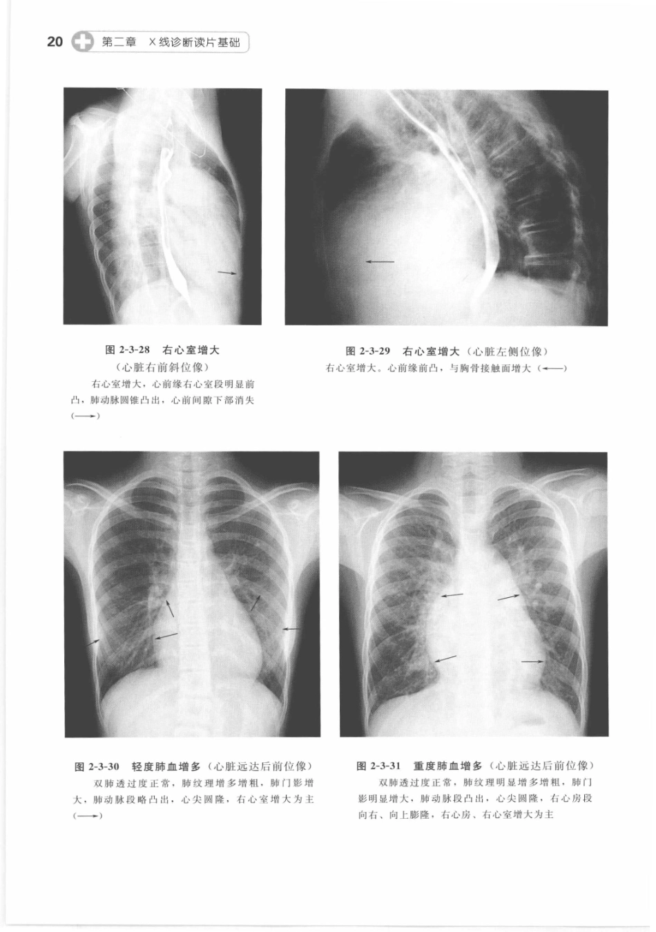 X线读片指南_13282062_31-45.pdf_第1页