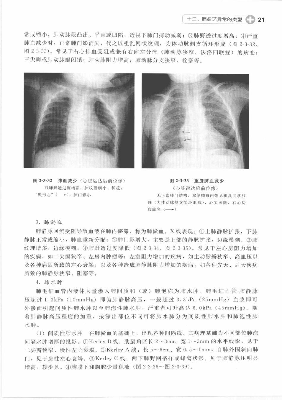 X线读片指南_13282062_31-45.pdf_第2页