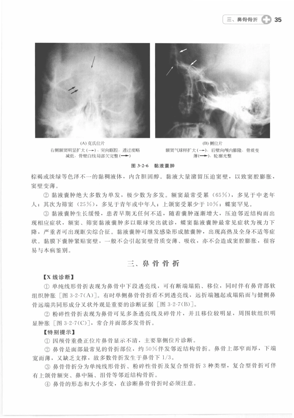 X线读片指南_13282062_46-60.pdf_第1页