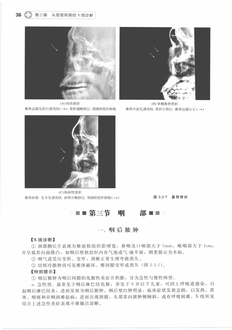 X线读片指南_13282062_46-60.pdf_第2页