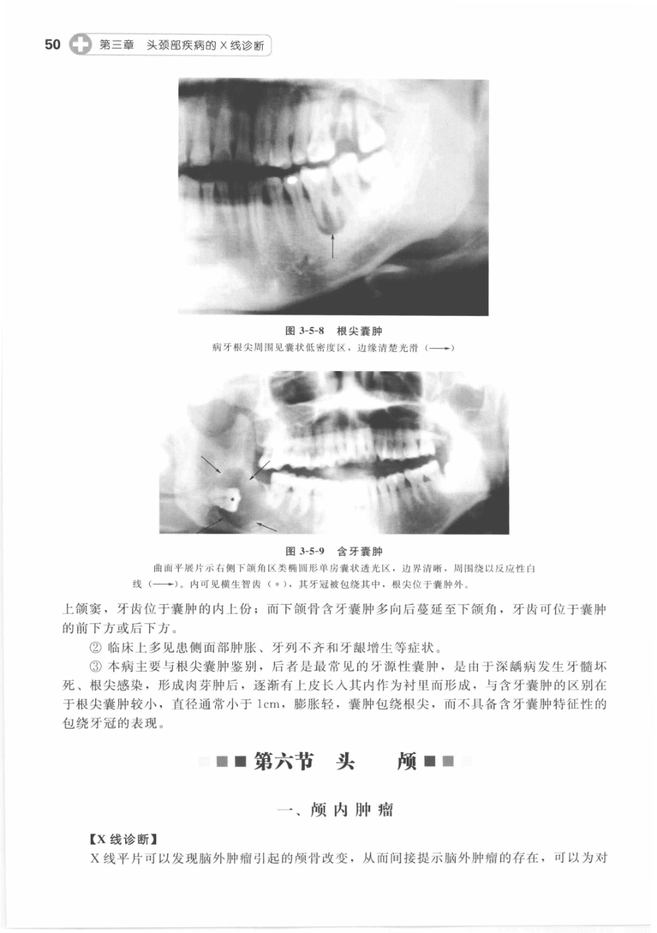 X线读片指南_13282062_61-75.pdf_第1页