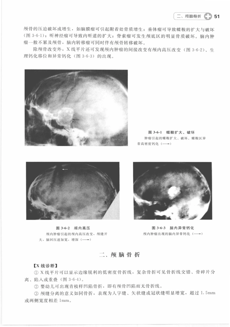 X线读片指南_13282062_61-75.pdf_第2页