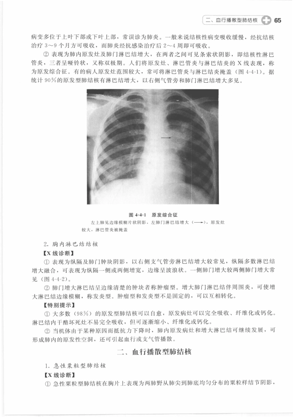 X线读片指南_13282062_76-90.pdf_第1页